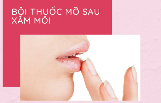 Tại sao nên xóa hình xăm tại Viện thẩm mỹ Việt Beauty Center  Việt Beauty  Center